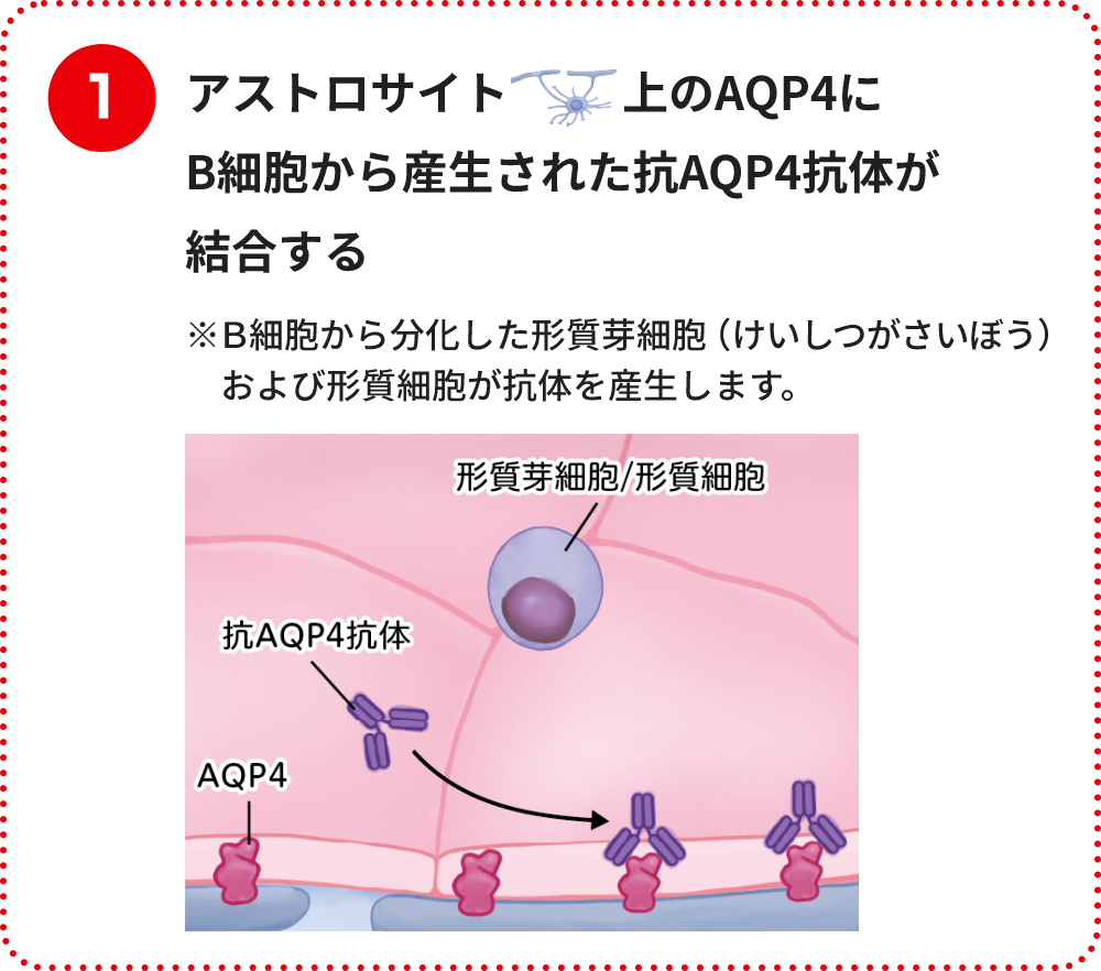 アストロサイト上のAQP4にB細胞から産生された抗AQP4抗体が結合する※Ｂ細胞から分化した形質芽細胞（けいしつがさいぼう）および形質細胞が抗体を産生します。